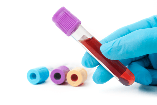 BASIC BLOOD TEST - KLINIK SENTOSA